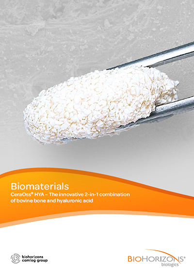 CeraOss HYA Flyer Cover of CeraOss HYA image flyer: Biomaterials CeraOss® HYA – The innovative 2-in-1 combination of bovine bone and hyaluronic acid